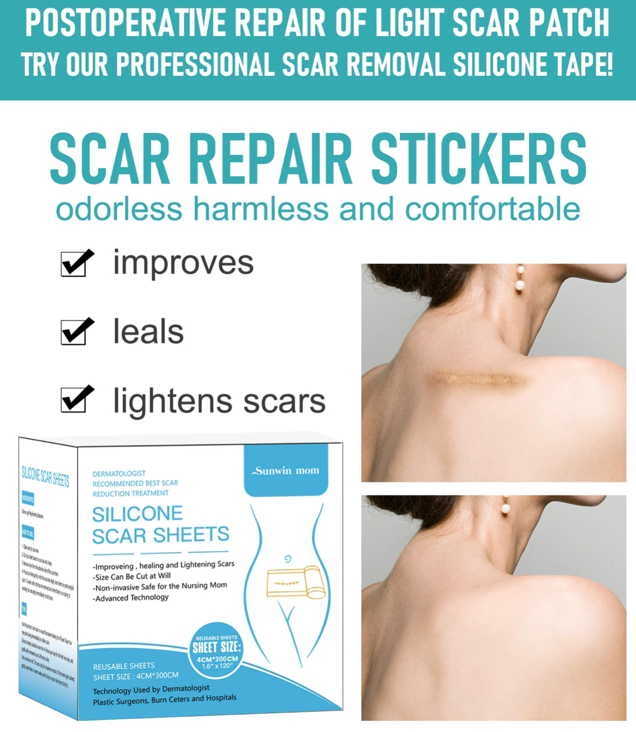 Effective Medical Grade Silicone Scar Sheet (4cm x1.5m roll)